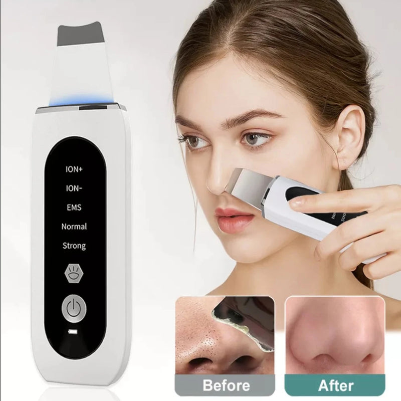 Face Deep Blackhead Remover