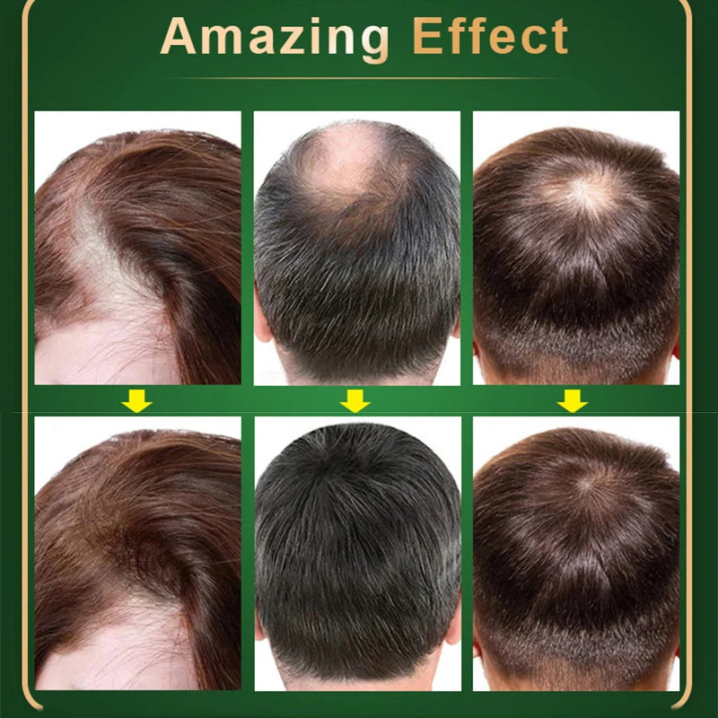 Hair Growth Orginal Natural Oil